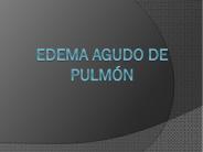 Edema Agudo de Pulm
