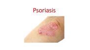 Psoriasis - Everything about it!!