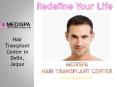 hair transplant in jaipur | hair transplant in delhi PowerPoint PPT Presentation