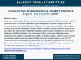 Global Organ Transplantation Market Research Report- Forecast To 2027 PowerPoint PPT Presentation