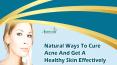 Natural Ways To Cure Acne And Get A Healthy Skin Effectively PowerPoint PPT Presentation