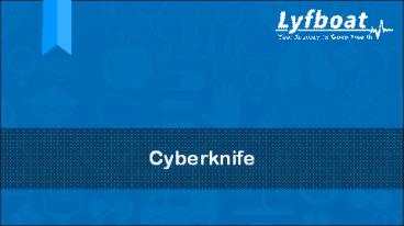 About Cyberknife - Symptoms, Treatment