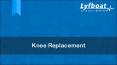 Knee Replacement In India - Cost, Hospitals, Surgeons - Lyfboat PowerPoint PPT Presentation