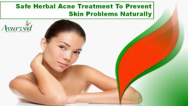 Safe Herbal Acne Treatment To Prevent Skin Problems Naturally
