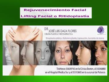 Rejuvenecimiento Facial Lifting Facial Ritidoplastia