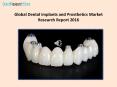 Global Dental Implants and Prosthetics Market Research Report 2016 PowerPoint PPT Presentation