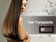 Hair Transplant