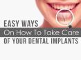 Easy Ways On How To Take Care Of Your Dental Implants PowerPoint PPT Presentation