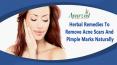 Herbal Remedies To Remove Acne Scars And Pimple Marks Naturally