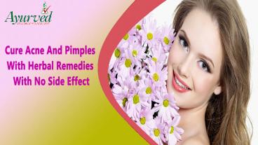Cure Acne And Pimples With Herbal Remedies With No Side Effect