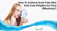 How To Achieve Acne Free Skin And Cure Pimples On Face Effectively? PowerPoint PPT Presentation