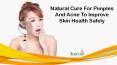 Natural Cure For Pimples And Acne To Improve Skin Health Safely PowerPoint PPT Presentation