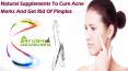 Natural Supplements To Cure Acne Marks And Get Rid Of Pimples PowerPoint PPT Presentation