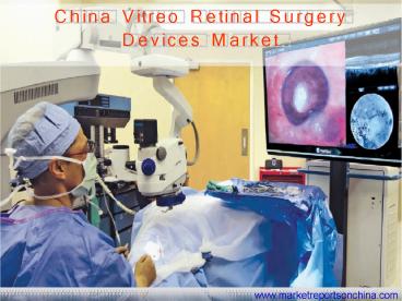 China Vitreo Retinal Surgery Devices Market