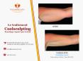 Coolsculpting à Québec - Remodelage corporel sans chirurgie PowerPoint PPT Presentation