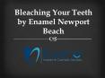 Bleaching Your Teeth by Enamel Newport Beach PowerPoint PPT Presentation