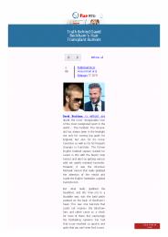 David Beckham hair transplant