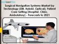 Surgical Navigation Systems Market by Technology (EM, Hybrid, Optical), Patient Care Setting (Hospital, Clinic, Ambulatory) - Forecasts to 2021 PowerPoint PPT Presentation