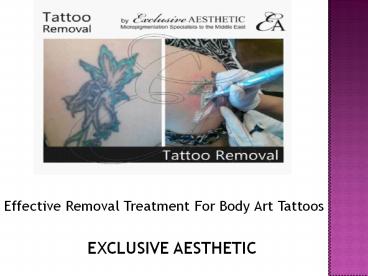 Effective Removal Treatment of body art tattoos