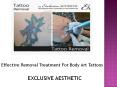Effective Removal Treatment of body art tattoos PowerPoint PPT Presentation