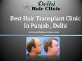Get natural hair with hair transplant clinic in Punjab,Delh PowerPoint PPT Presentation
