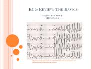 ECG%20Review:%20The%20Basics