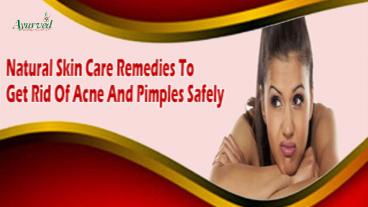 Natural Skin Care Remedies To Get Rid Of Acne And Pimples Safely