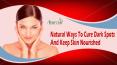 Natural Ways To Cure Dark Spots And Keep Skin Nourished PowerPoint PPT Presentation