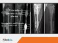 Extremity Reconstruction Market Analysis with Segments and Forecasts PowerPoint PPT Presentation