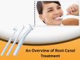 An Overview of Root Canal Treatment PowerPoint PPT Presentation