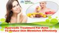 Ayurvedic Treatment For Acne To Reduce Skin Blemishes Effectively