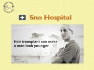 Fue Hair Transplant in Chandigarh (1)