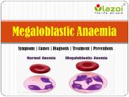 Megaloblastic Anaemia: Symptoms, causes, diagnosis, treatment and preventions.