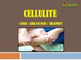 Cellulite: Causes, risk factors and treatment PowerPoint PPT Presentation