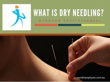 What Is Dry Needling?