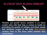 Platelet Rich Plasma Therapy Boca Raton Florida