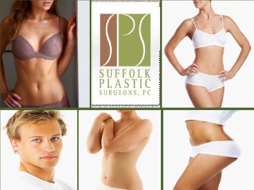 Breast Augmentation Suffolk NY