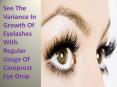 See The Variance In Growth Of Eyelashes With Regular Usage Of Careprost Eye Drop (1) PowerPoint PPT Presentation