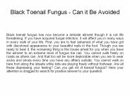 Black Toenail Fungus - Can it Be Avoided