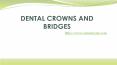 Dental Crowns and Bridges PowerPoint PPT Presentation