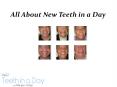 About New Teeth in a Day PowerPoint PPT Presentation