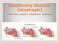 Swallowing disorder (dysphagia) in children- Causes, Symptoms, Diagnosis and Treatment PowerPoint PPT Presentation