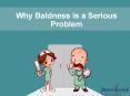 Why Baldness is a Serious Problem among Human Beings PowerPoint PPT Presentation