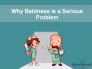 Why Baldness is a Serious Problem among Human Beings