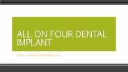 All on Four Dental Implants