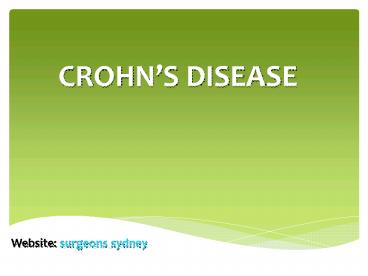 Crohns disease