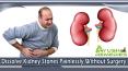 Dissolve Kidney Stones Painlessly Without Surgery PowerPoint PPT Presentation
