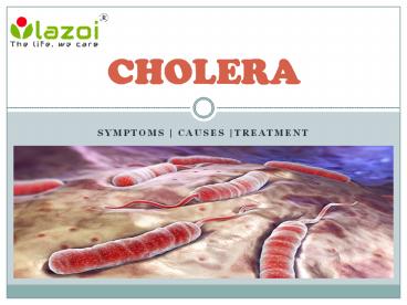 Cholera : Symptoms, causes and treatment
