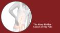 The Many Hidden Causes of Hip Pain PowerPoint PPT Presentation
