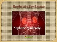 Nephrotic Syndrome: Causes, Symptoms and Treatment